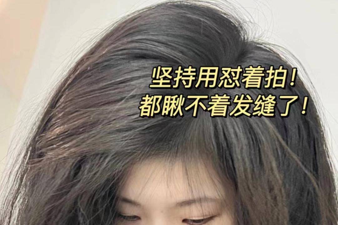 脱发上岸真谛分享！真希望所有脱发星人都刷到！分分钟发量逆袭！